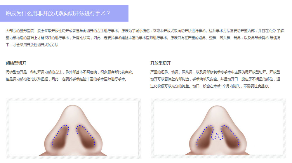 原辰整形医院鼻形矫正