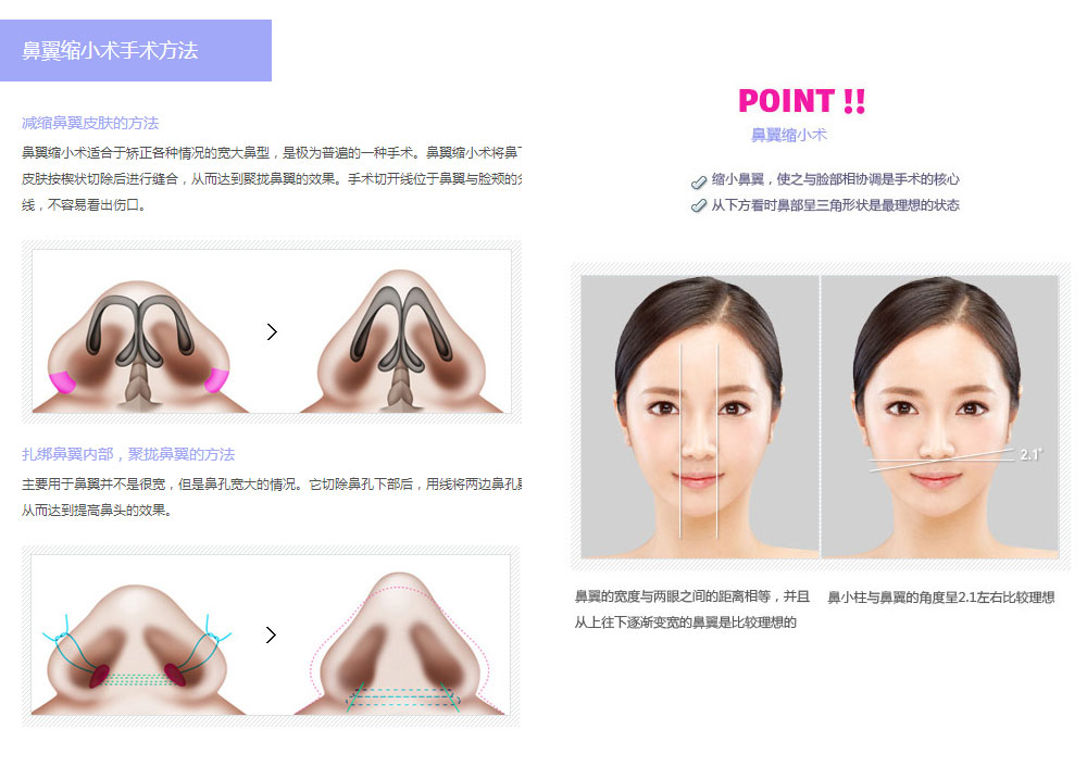 自体软骨整形