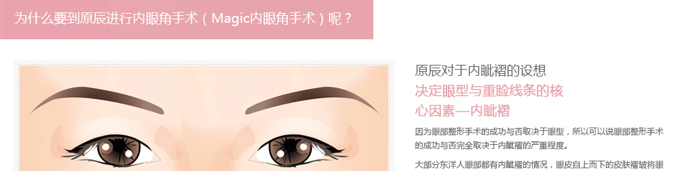 开内眼角手术恢复过程