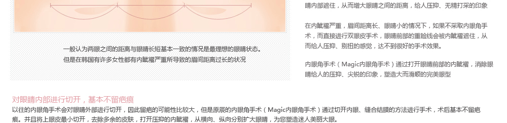 开内眼角手术恢复过程