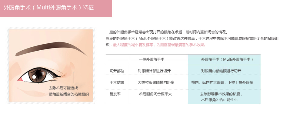 韩式开外眼角手术需要多少钱