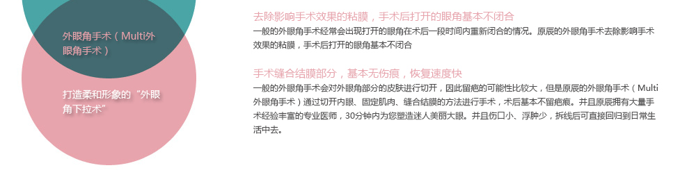 为什么选择韩国原辰整形外科医院的开外眼角手术