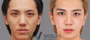 韩国皮肤护理