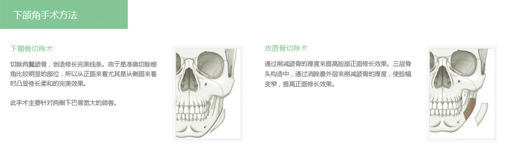 韩国下颌角整形医院排名榜