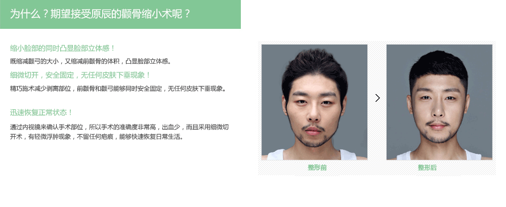 韩国做颧骨整形最好的医院