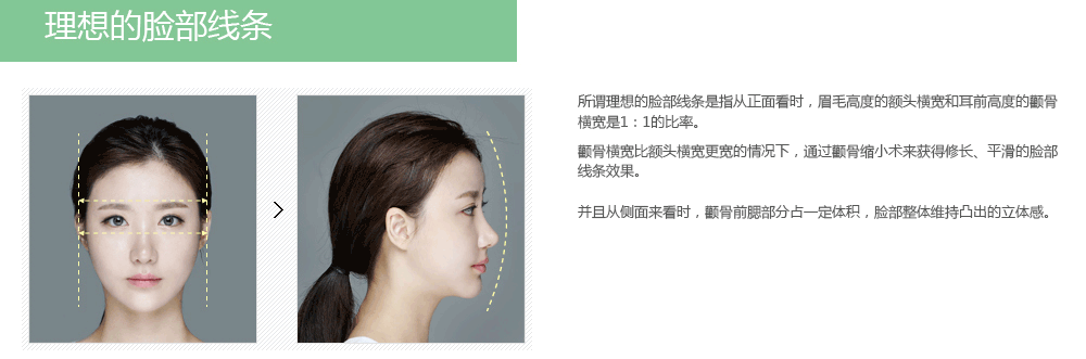 韩国颧骨整形手术的价格
