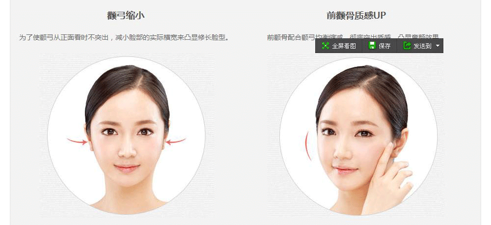 韩国颧骨整形手术的价格