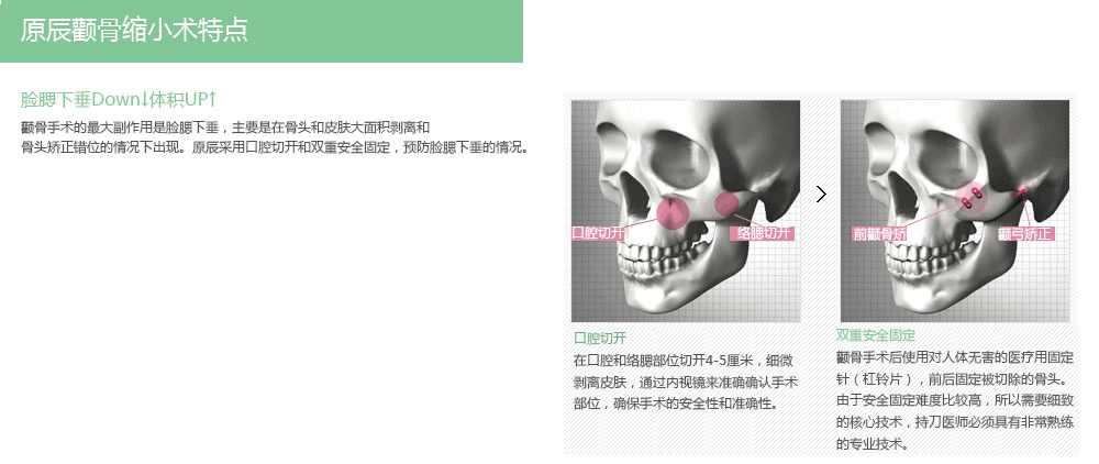 韩国颧骨整形哪个医院最好