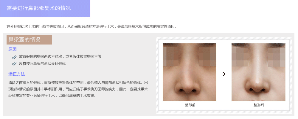 韩国鼻部整形修复医院哪里好
