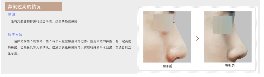 韩国鼻部整形修复的价格