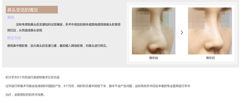 韩国鼻部整形修复哪里做的好