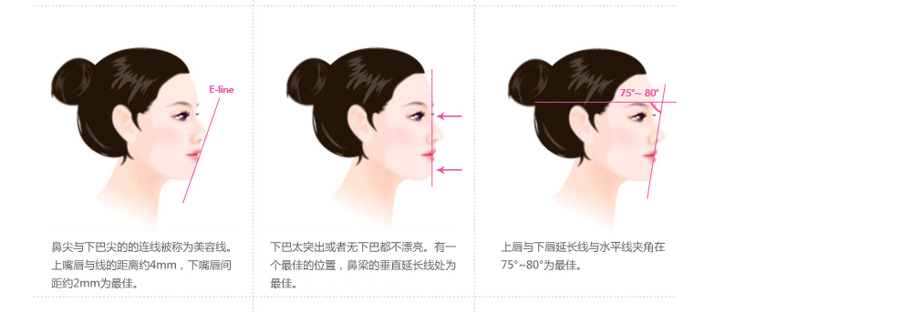 韩国假体隆鼻专家