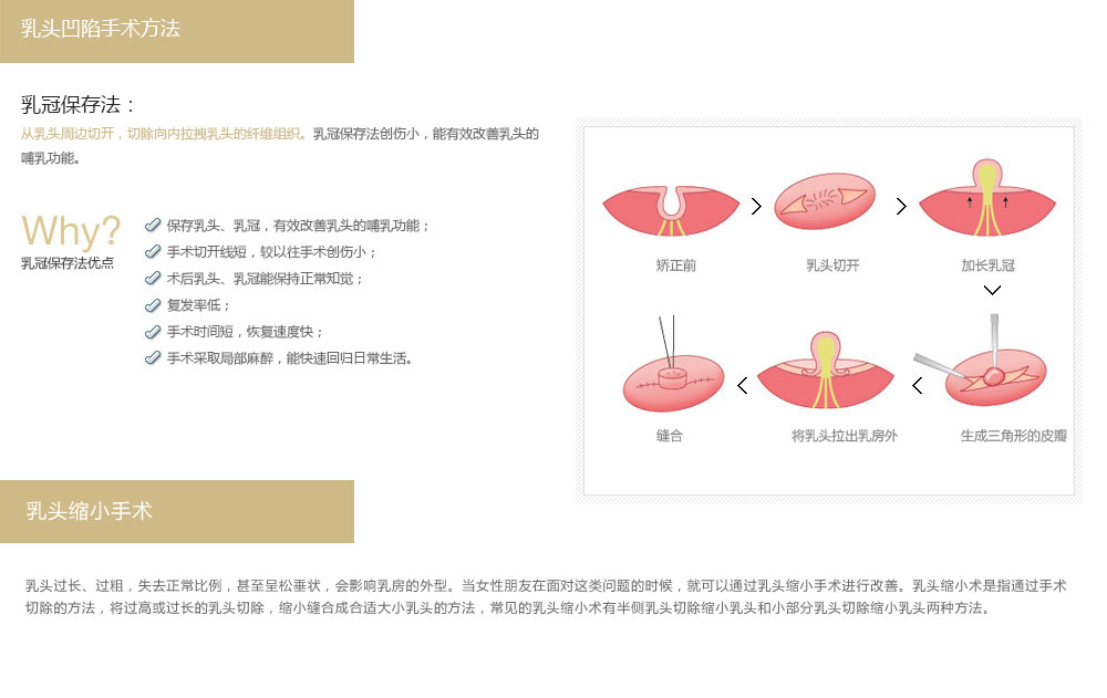 韩国乳头塑形最好的医院