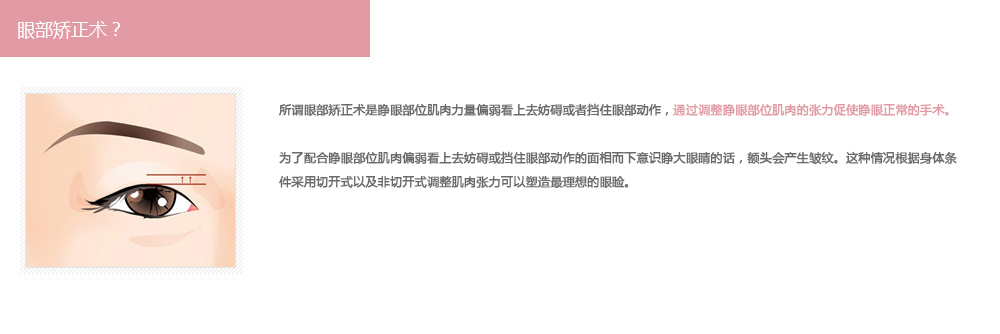 切开式上眼睑矫正术