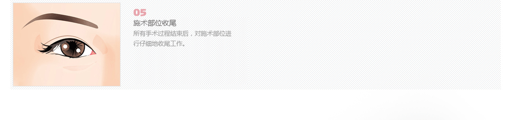 韩式眼底脂肪去除