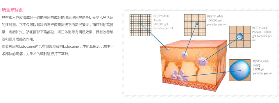 瑞蓝玻尿酸效果怎么样