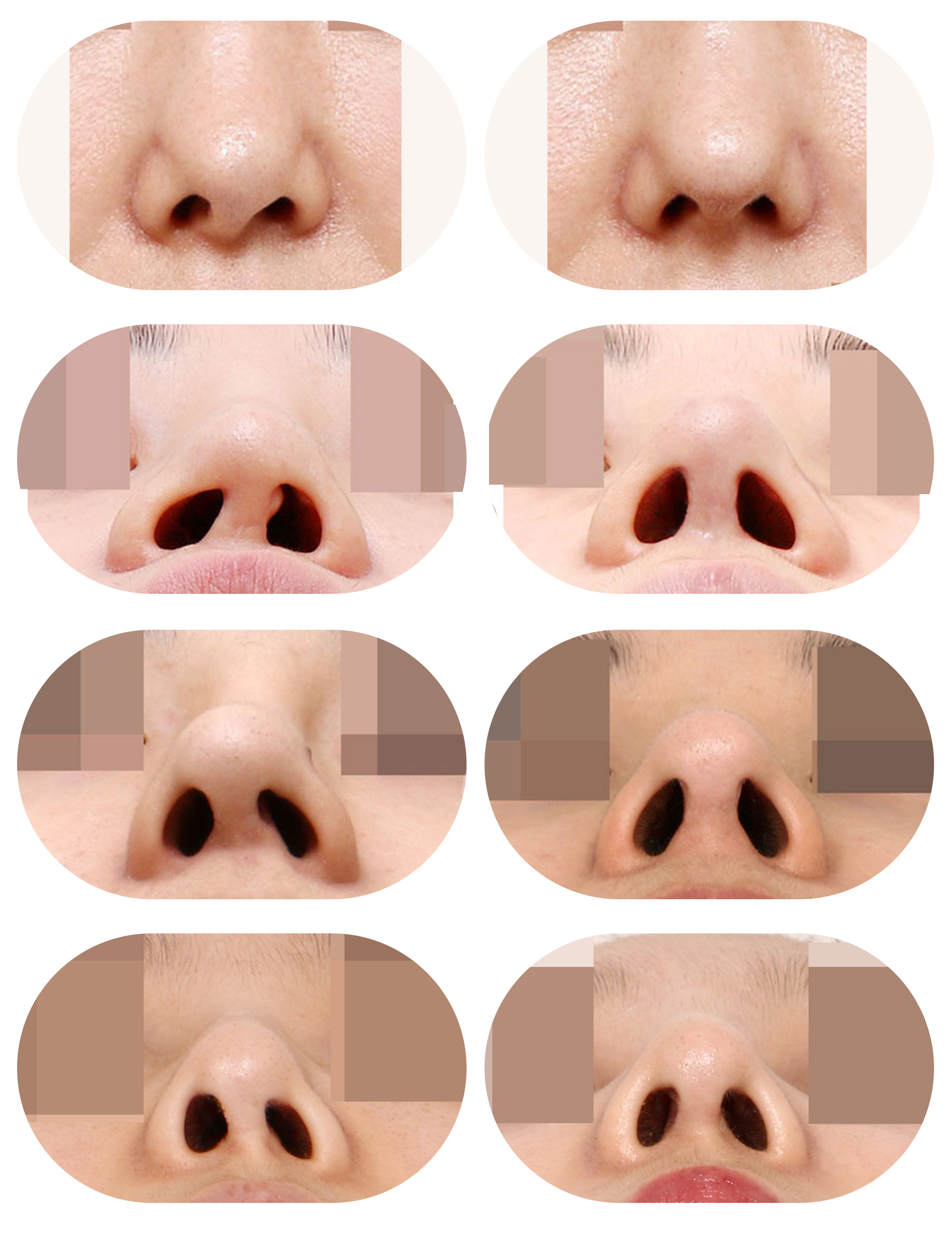 ǰԱƬ