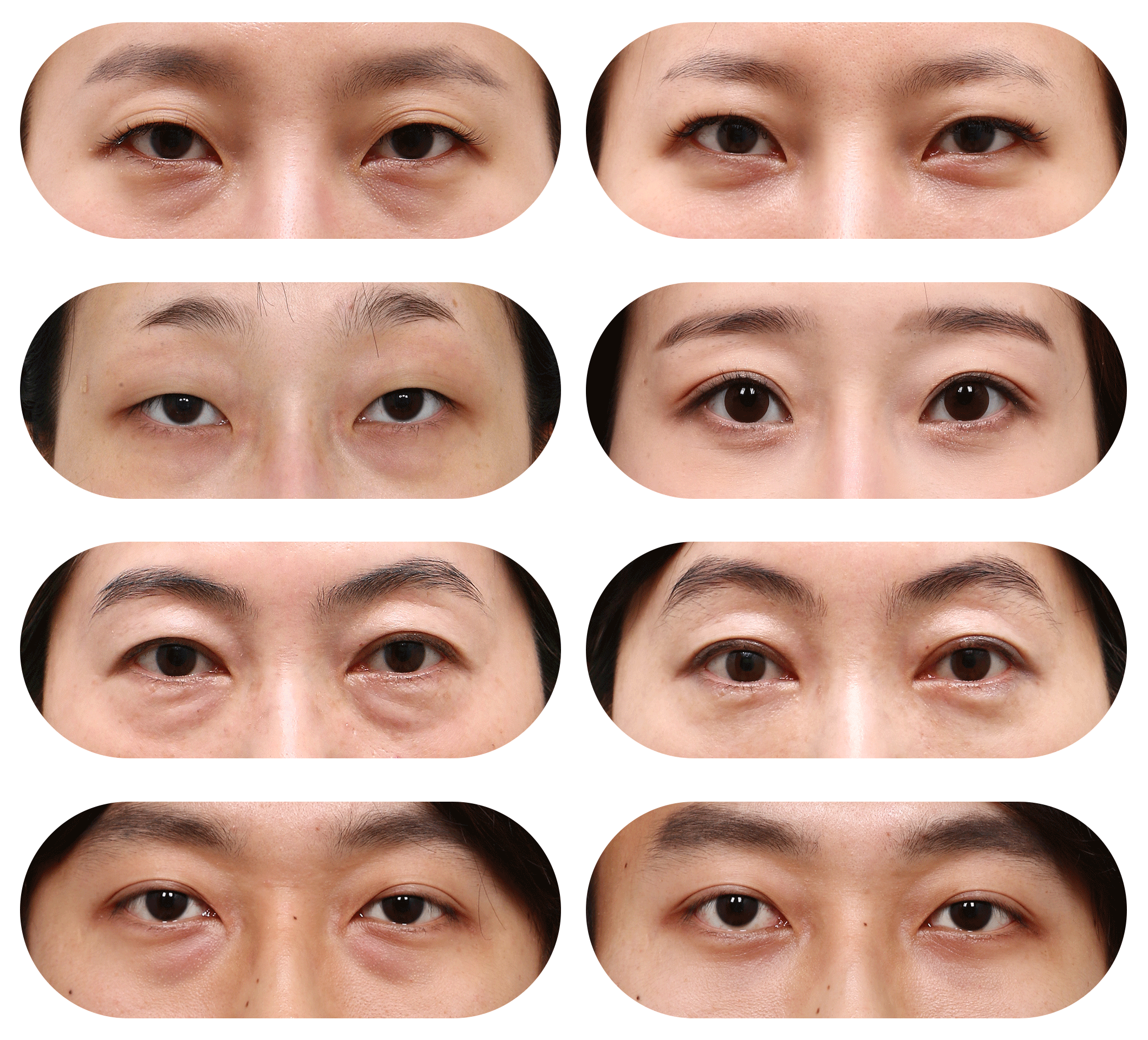 ǰĶԱƬ