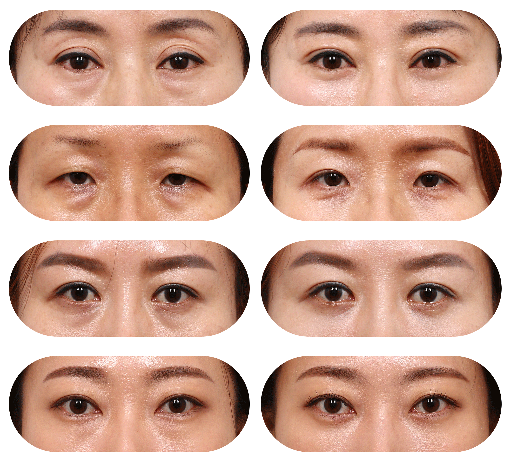 ǰĶԱƬ
