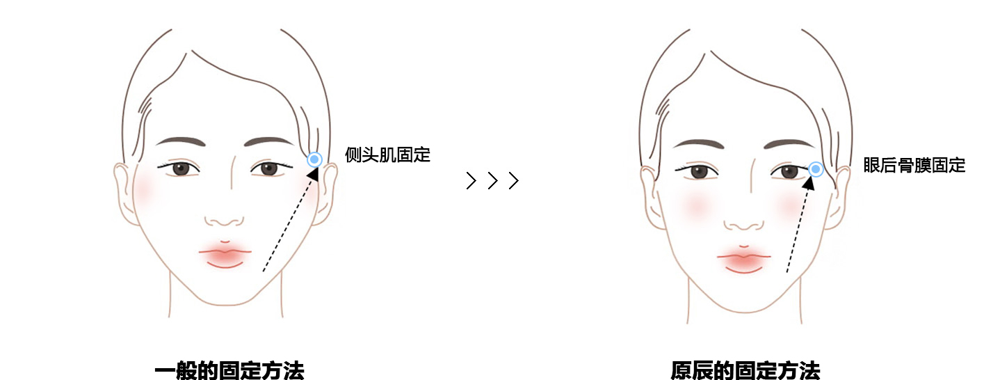 WJԭСɵ