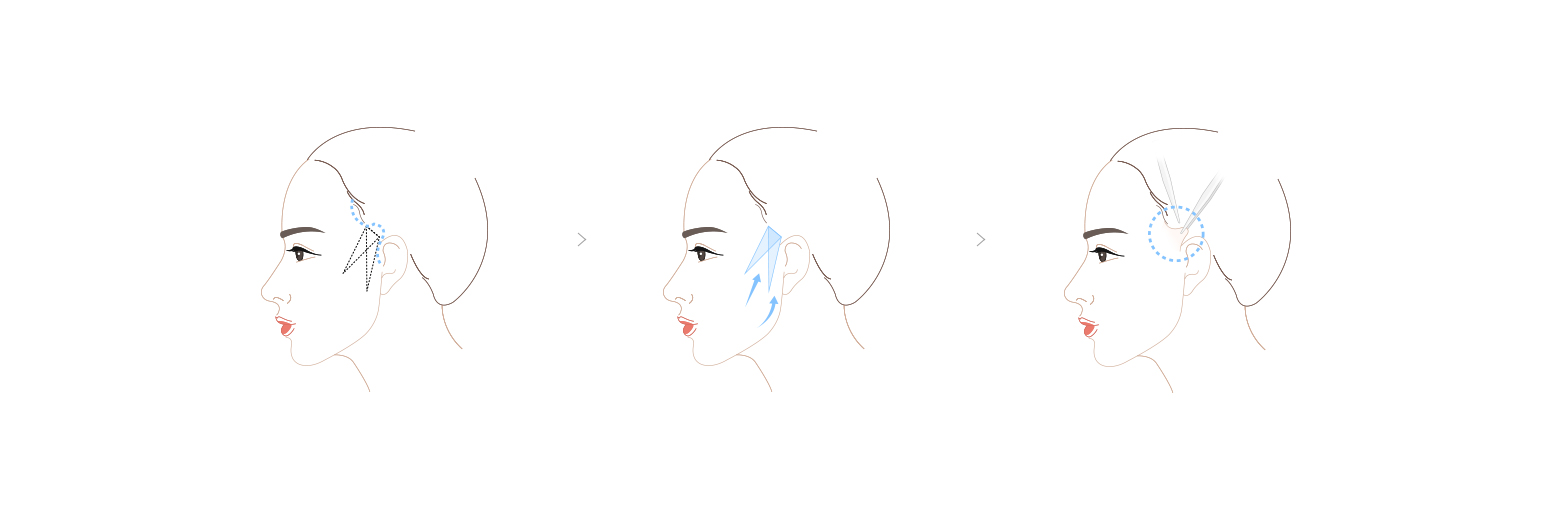 沿ͼ