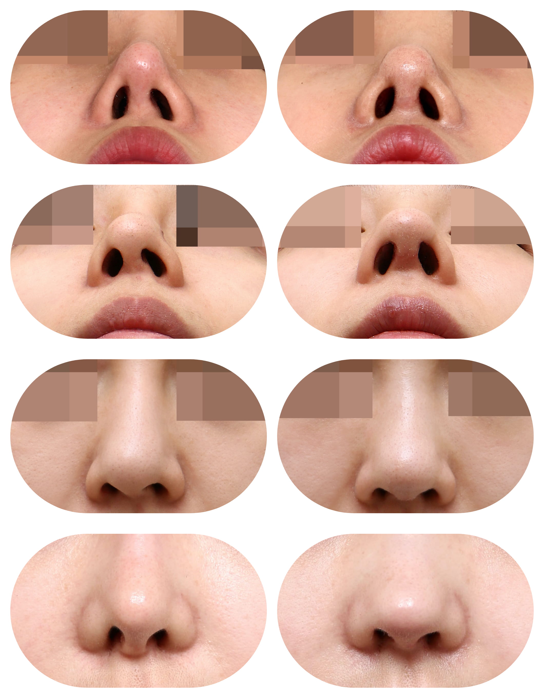ǰԱƬ