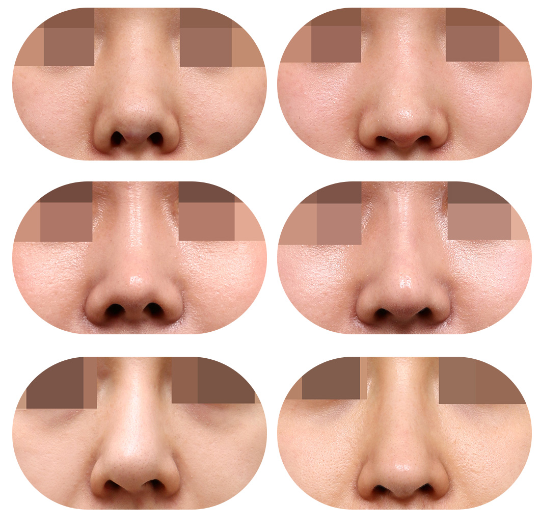 ǰԱƬ